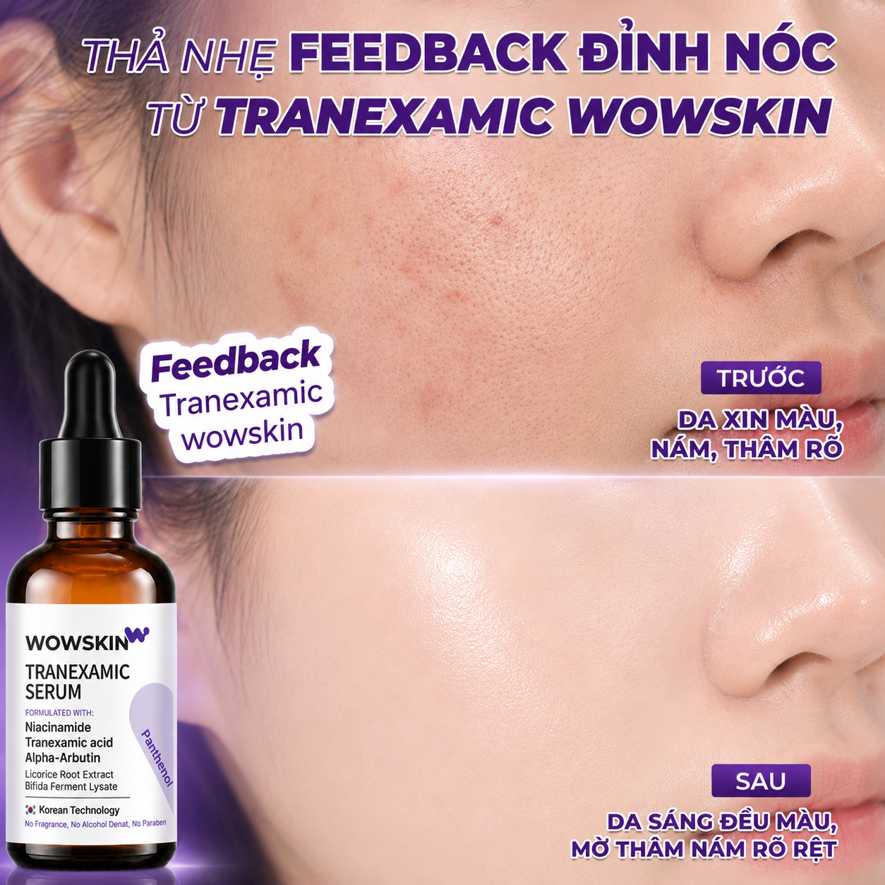 b8f35ea3-514c-4423-b34a-c5fd5b09588b serum tranexamic wowskin